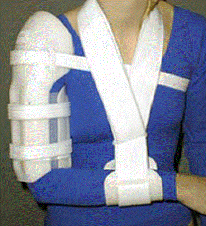 Universal Humeral Fracture Brace