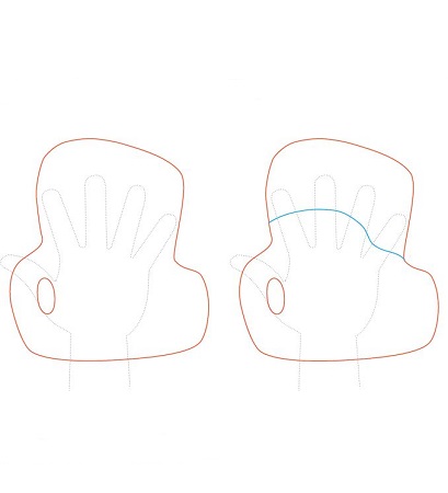 Precut Splinting